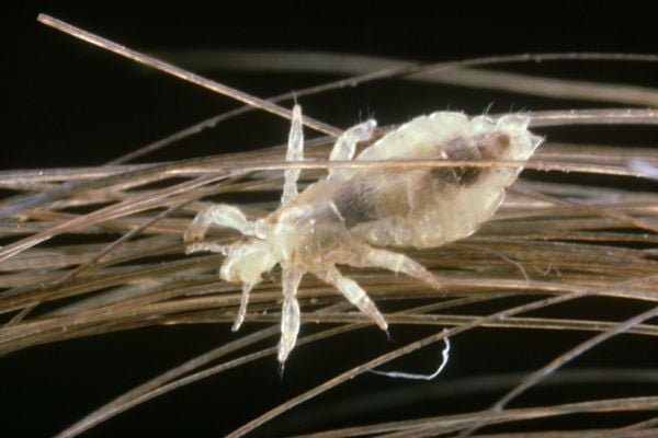 Lice under the microscope